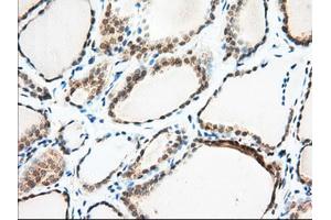 Immunohistochemical staining of paraffin-embedded Human Kidney tissue using anti-MIOX mouse monoclonal antibody. (MIOX anticorps)