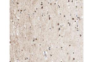 ABIN6267012 at 1/100 staining human brain tissue sections by IHC-P. (CTBP1 anticorps  (Internal Region))