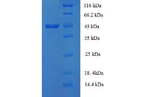 SDS-PAGE (SDS) image for Collagen, Type XVIII, alpha 1 (COL18A1) (AA 1578-1754) protein (GST tag) (ABIN5712828)