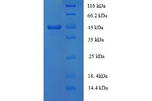 SDS-PAGE (SDS) image for Collagen, Type XVIII, alpha 1 (COL18A1) (AA 1578-1754) protein (GST tag) (ABIN5712828) (COL18A1 Protein (AA 1578-1754) (GST tag))