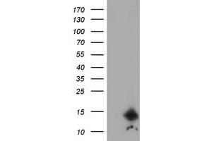 Image no. 1 for anti-Cystatin C (CST3) antibody (ABIN1497753) (CST3 anticorps)