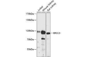 Western blot analysis of extracts of various cell lines, using ERCC3 antibody (ABIN6127770, ABIN6140267, ABIN6140268 and ABIN6216436) at 1:3000 dilution. (ERCC3 anticorps  (AA 512-782))