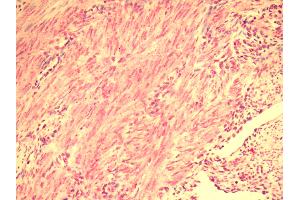 Human Uterus: Formalin-Fixed, Paraffin-Embedded (FFPE) (RXFP2 anticorps  (Cytoplasmic Domain))
