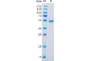 Human CA9 Protein, His Tag on SDS-PAGE under reducing condition.