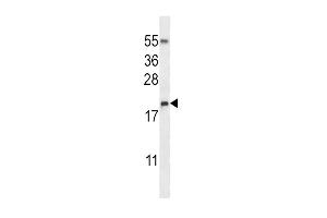 Western blot analysis in NCI-H460 cell line lysates (35ug/lane). (RNASE3 anticorps  (C-Term))