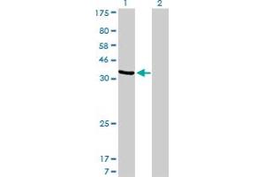 Western Blot analysis of AKR1D1 expression in transfected 293T cell line by AKR1D1 monoclonal antibody (M03), clone 1C2.