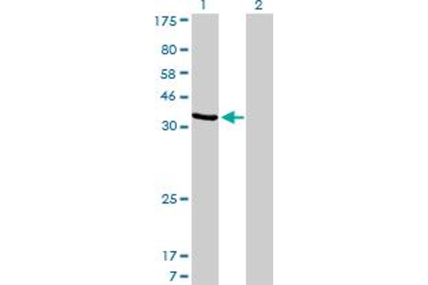 AKR1D1 antibody  (AA 227-326)
