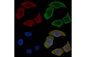 ABIN6263599 and ABIN6277934 staining Hela cells(30 min of UV treatment) by IF/ICC. (Nestin anticorps  (C-Term))