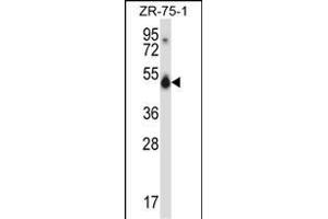 CUGBP1 Antibody (N-term) (ABIN657957 and ABIN2846902) western blot analysis in ZR-75-1 cell line lysates (35 μg/lane). (CELF1 anticorps  (N-Term))