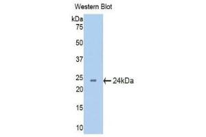 Western Blotting (WB) image for anti-Crystallin, beta B2 (CRYbB2) (AA 17-191) antibody (ABIN1077954) (CRYbB2 anticorps  (AA 17-191))