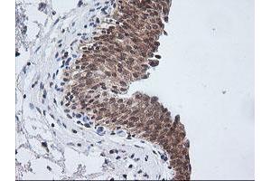 Image no. 3 for anti-V-Ets Erythroblastosis Virus E26 Oncogene Homolog 2 (ETS2) (AA 90-349) antibody (ABIN1491702) (ETS2 anticorps  (AA 90-349))