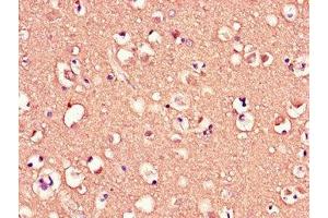 Immunohistochemistry of paraffin-embedded human brain tissue using ABIN7159104 at dilution of 1:100