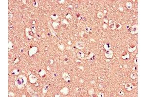 Immunohistochemistry of paraffin-embedded human brain tissue using ABIN7159104 at dilution of 1:100 (MED12 anticorps  (AA 1742-2011))