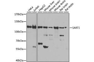 Western blot analysis of extracts of various cell lines, using SART1 antibody.