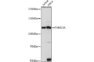 Western blot analysis of extracts of various cell lines, using FA antibody (ABIN7267109) at 1:1000 dilution. (FAM13A anticorps  (AA 1-200))