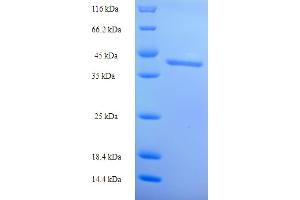 SDS-PAGE (SDS) image for Dynamin 1 (DNM1) (AA 2-245), (partial) protein (His-SUMO Tag) (ABIN5709409)