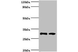Western blot All lanes: RPA4 antibody at 3 μg/mL Lane 1: K562 whole cell lysate Lane 2: Mouse spleen tissue Secondary Goat polyclonal to rabbit IgG at 1/10000 dilution Predicted band size: 29 kDa Observed band size: 29 kDa (RPA4 anticorps  (AA 1-230))