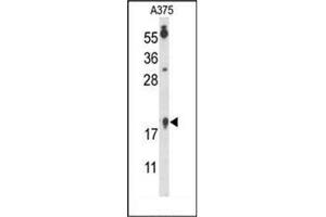 Western blot analysis of FAM96B Antibody (N-term) in A375 cell line lysates (35ug/lane).
