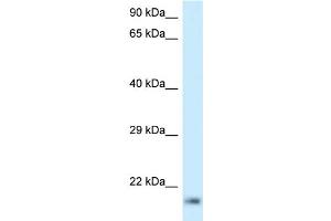 WB Suggested Anti-RPL23A Antibody Titration: 1. (RPL23A anticorps  (C-Term))