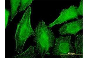 Immunofluorescence of monoclonal antibody to DST on HeLa cell.