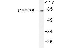 Image no. 1 for anti-Heat Shock 70kDa Protein 5 (Glucose-Regulated Protein, 78kDa) (HSPA5) antibody (ABIN265447)