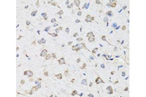 Immunohistochemistry of paraffin-embedded Mouse brain using USP25 Polyclonal Antibody at dilution of 1:100 (40x lens).