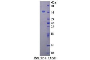 SDS-PAGE (SDS) image for Transcription Termination Factor, RNA Polymerase I (TTF1) (AA 612-747) protein (His tag,GST tag) (ABIN4990601)