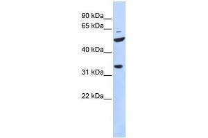 WB Suggested Anti-ZFP36L2 Antibody Titration:  0. (ZFP36L2 anticorps  (N-Term))