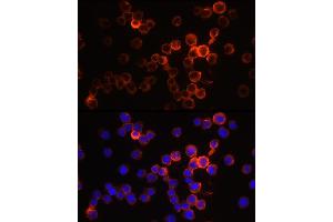 Immunofluorescence analysis of THP-1 cells using Neutrophil Elastase (ELANE) Rabbit pAb (ABIN6131604, ABIN6140110, ABIN6140111 and ABIN6216843) at dilution of 1:250 (40x lens).