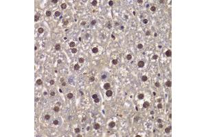 Immunohistochemistry of paraffin-embedded mouse liver using SMARCB1 antibody at dilution of 1:200 (400x lens). (SMARCB1 anticorps)