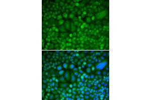 Immunofluorescence (IF) image for anti-Cyclin H (CCNH) (AA 1-323) antibody (ABIN3021259) (Cyclin H anticorps  (AA 1-323))
