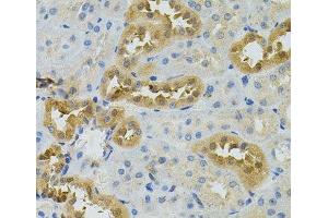 Immunohistochemistry of paraffin-embedded Rat kidney using NAT8 Polyclonal Antibody
