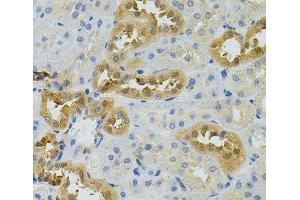 Immunohistochemistry of paraffin-embedded Rat kidney using NAT8 Polyclonal Antibody (NAT8 anticorps)