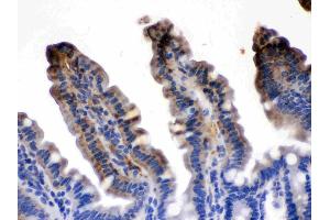 FABP2/I-FABP was detected in paraffin-embedded sections of mouse intestine tissues using rabbit anti- FABP2/I-FABP Antigen Affinity purified polyclonal antibody (Catalog # ) at 1 µg/mL.