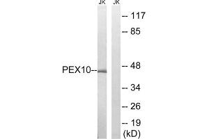 Western blot analysis of extracts from Jurkat cells, using PEX10 antibody. (PEX10 anticorps  (Internal Region))