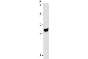 Western Blotting (WB) image for anti-Internexin Neuronal Intermediate Filament Protein, alpha (INA) antibody (ABIN2426549) (INA anticorps)