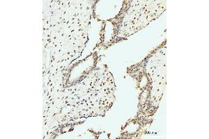 IHC analysis of AKAP 95/AKAP8 using anti-AKAP 95/AKAP8 antibody (ABIN7601553). (AKAP8 anticorps  (AA 380-546))