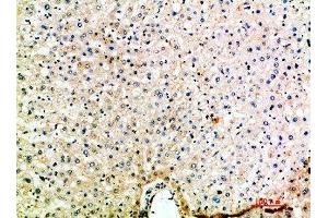 Immunohistochemical analysis of paraffin-embedded human-liver, antibody was diluted at 1:200 (CCL15 anticorps  (AA 51-100))