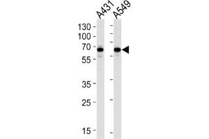 Western Blotting (WB) image for anti-Stress-Induced-phosphoprotein 1 (STIP1) antibody (ABIN3001649)