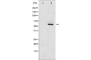 Western blot analysis of Estrogen Receptor- beta phosphorylation expression in HepG2 whole cell lysates,The lane on the left is treated with the antigen-specific peptide. (ESR2 anticorps  (pSer105))