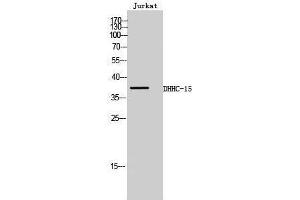 Western Blotting (WB) image for anti-Zinc Finger, DHHC-Type Containing 15 (ZDHHC15) (C-Term) antibody (ABIN3174754) (ZDHHC15 anticorps  (C-Term))