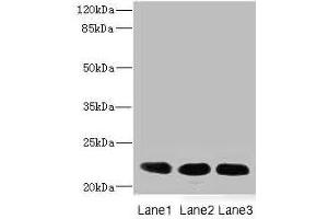 Western blot All lanes: CRIP2 antibody at 4. (CRIP2 anticorps  (AA 1-208))