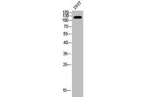 Western Blot analysis of 293T cells using Phospho-FAK (Y407) Polyclonal Antibody (FAK anticorps  (pTyr407))