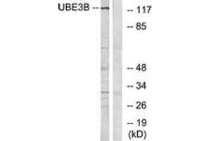 Western blot analysis of extracts from Jurkat cells, using UBE3B Antibody. (UBE3B anticorps  (AA 581-630))