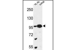 Western blot analysis of CS Antibody (N-term) (ABIN653334 and ABIN2842822) in HL-60, Jurkat cell line lysates (35 μg/lane). (CSPP1 anticorps  (N-Term))