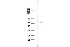 anti-Serotonin Receptor 3A (HTR3A) (Internal Region) antibody