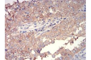 Immunohistochemistry (IHC) image for anti-Wingless-Type MMTV Integration Site Family, Member 3A (WNT3A) (AA 170-352) antibody (ABIN5906379) (WNT3A anticorps  (AA 170-352))