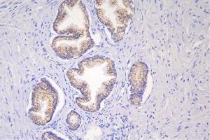 IHC analysis of DSG2 using anti-DSG2 antibody (ABIN7600803). (Desmoglein 2 anticorps  (AA 24-1020))