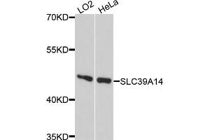 Western blot analysis of extracts of various cell lines, using SLC39A14 antibody. (SLC39A14 anticorps)