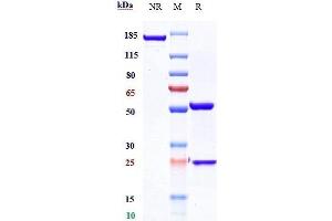 Anti-CXCR4 / CD184 Reference Antibody (ulocuplumab) on SDS-PAGE under reducing (R) condition. (Recombinant CXCR4 (Ulocuplumab Biosimilar) anticorps)
